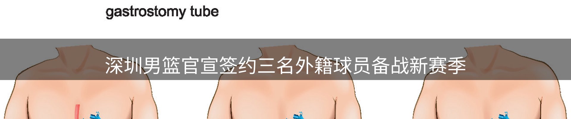 热点看台