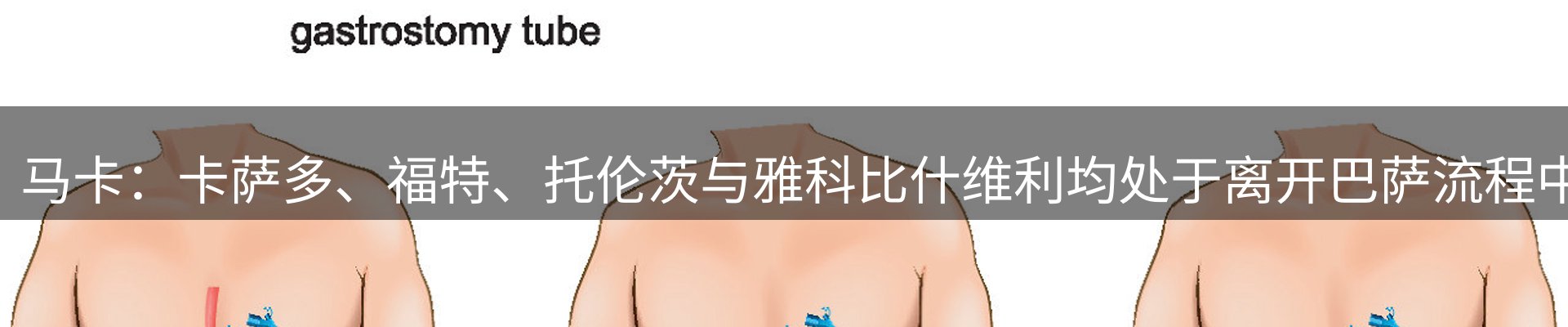 热点看台